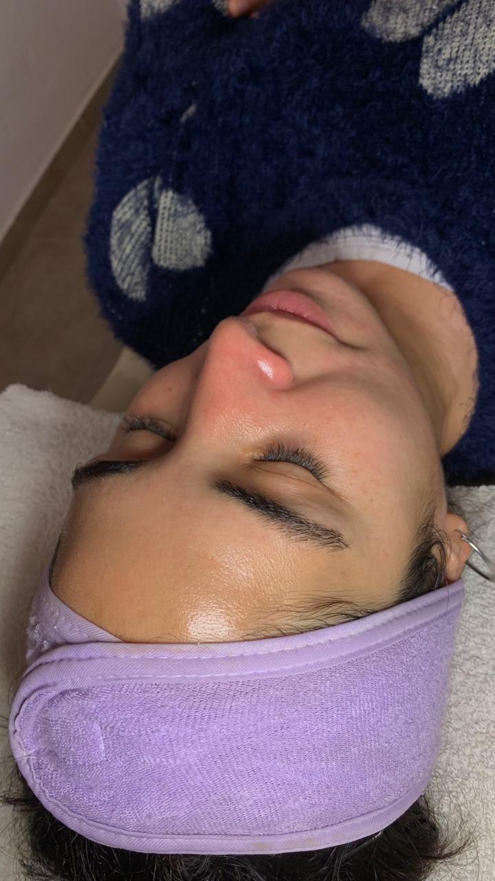 Dermaplaning